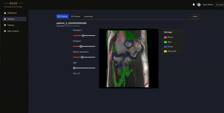 Запис з екрана від 2025-07-10 15-35-59